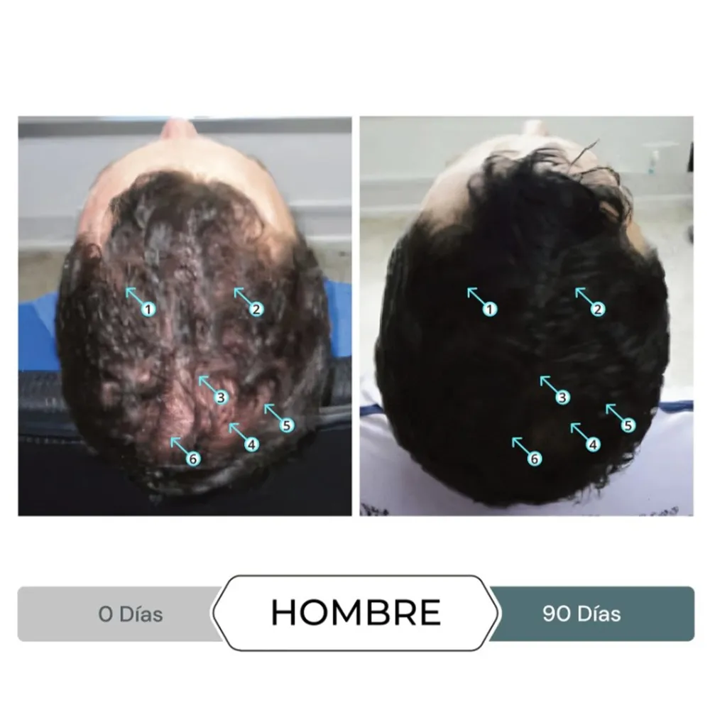 Tratamiento capilar Spectral F7 para perdida de cabello - 60 ml